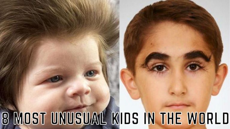 8 Most Unusual Kids Around The World You’ll Be Shoked To Know