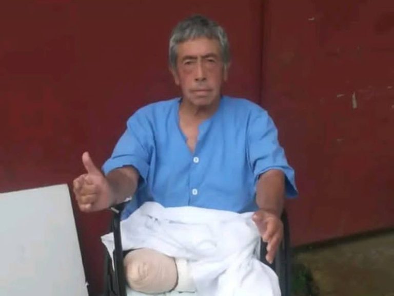 72-year-old martial arts instructor contracted a bacteria in the Darien Gap and lost his leg